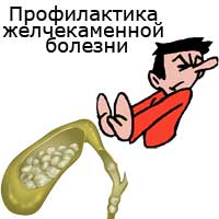 профилактика желчекаменной болезни