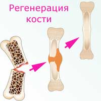 регенерация кости