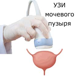 УЗИ мочевого пузыря