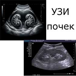 ультразвуковое исследование почек