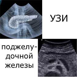 УЗИ поджелудочной железы