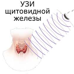 УЗИ щитовидной железы