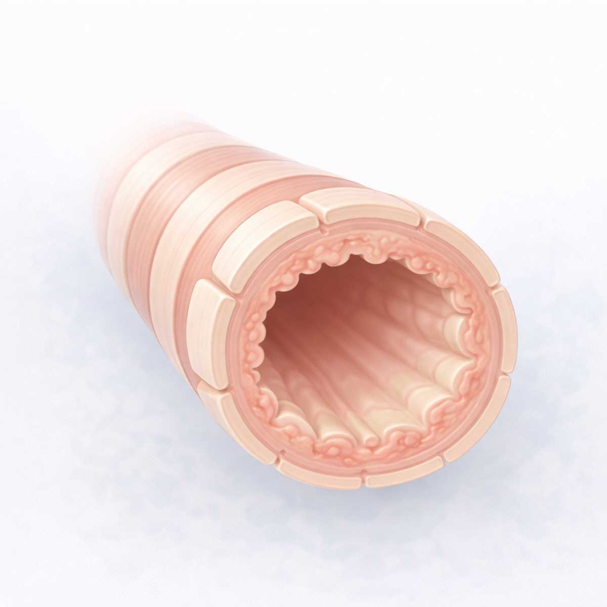 Схематичное строение стенки бронха: слизистая оболочка, мышечный слой и хрящевые элементы.