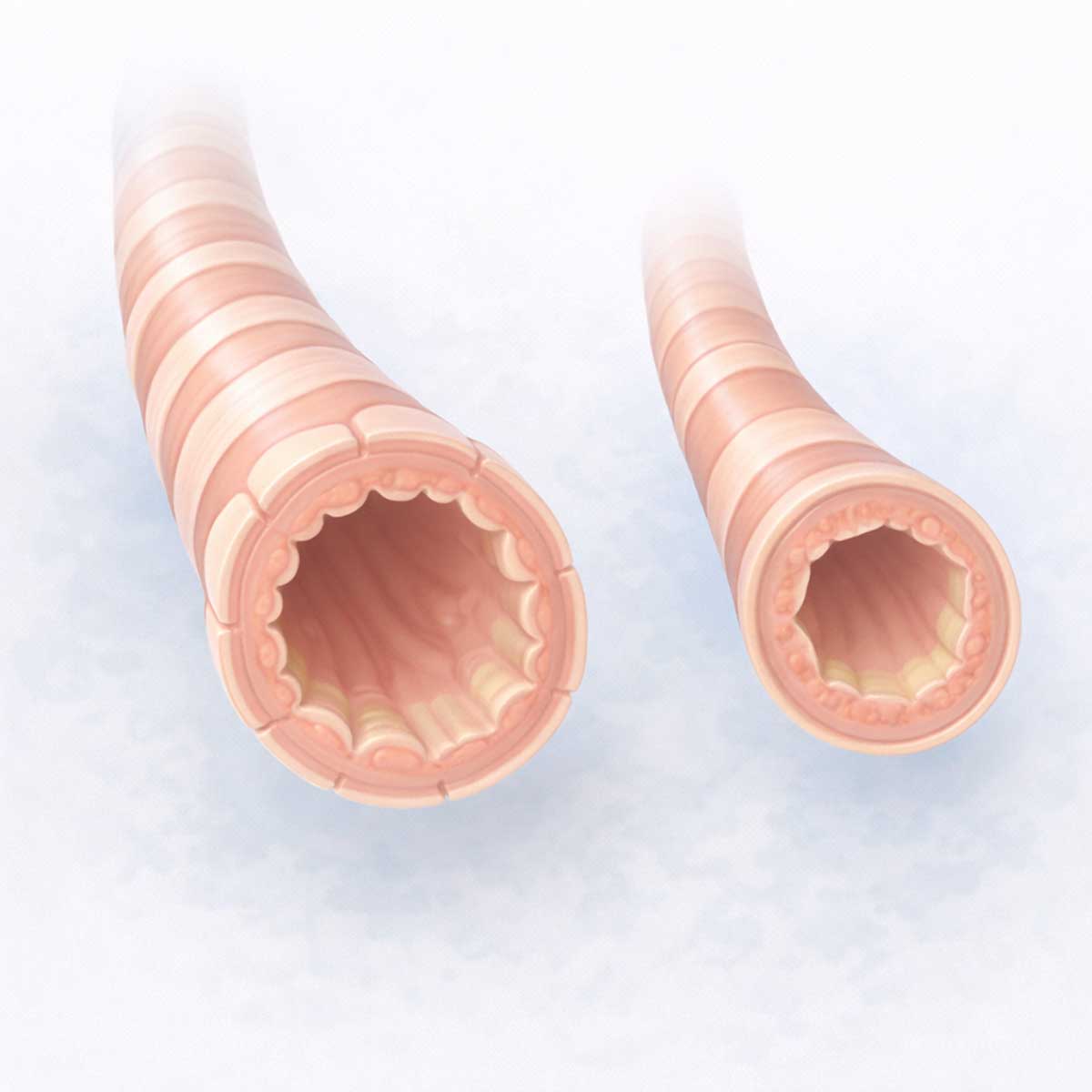 Сравнение строения бронхов и бронхиол: различия в диаметре, наличии хряща и мышечном слое.