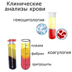 клинические анализы крови