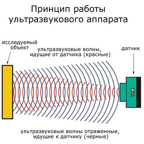 принцип работы ультразвукового аппарата
