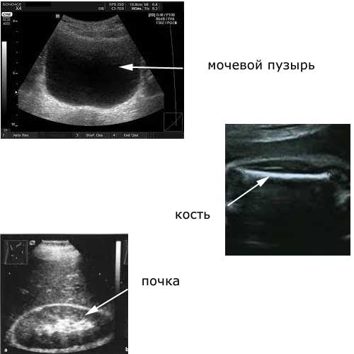 изображение разных анатомических структур при УЗИ