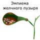 эмпиема желчного пузыря
