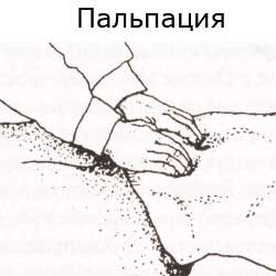 пальпация