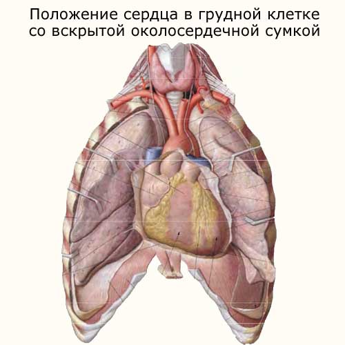 сердце в грудной клетке со вскрытой околосердечной сумкой