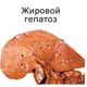 жировой гепатоз