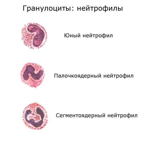 нейтрофилы, разные формы: юный, палочкоядерный и сегментоядерный