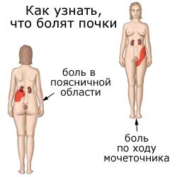 как узнать, что болят почки