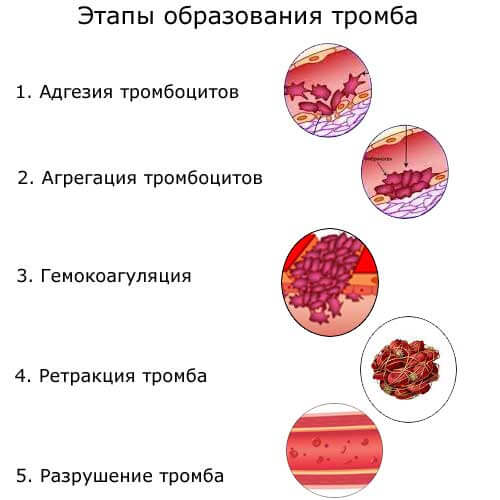 Как образуется тромб, этапы