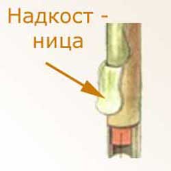 надкостница или периост