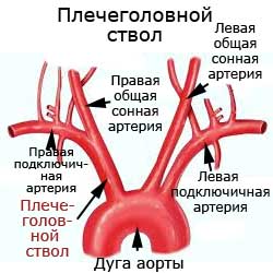 плечеголовной ствол