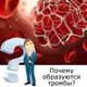 человек спрашивает почему образуются тромбы
