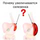 почему увеличена селезенка