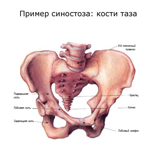 Синостоз: кости таза