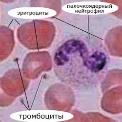 тромбоциты среди других клеток крови